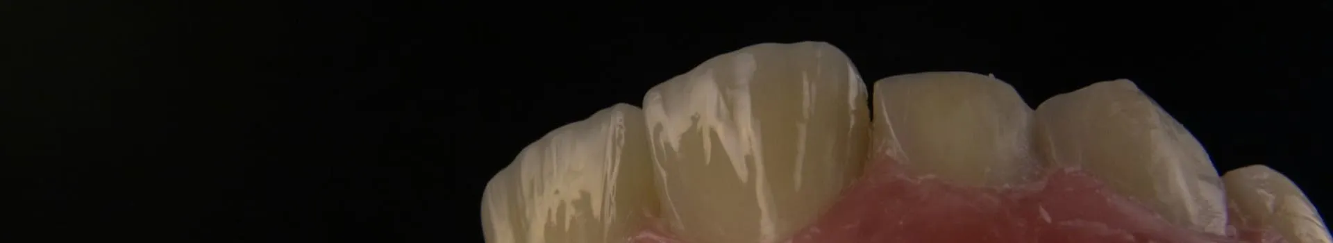 banner img
