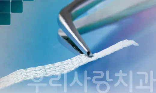 핀셋으로 잡고 있는 흰색 격자 구조의 립본드 초고분자량 폴리에틸렌 강화 섬유 리본 확대 사진
