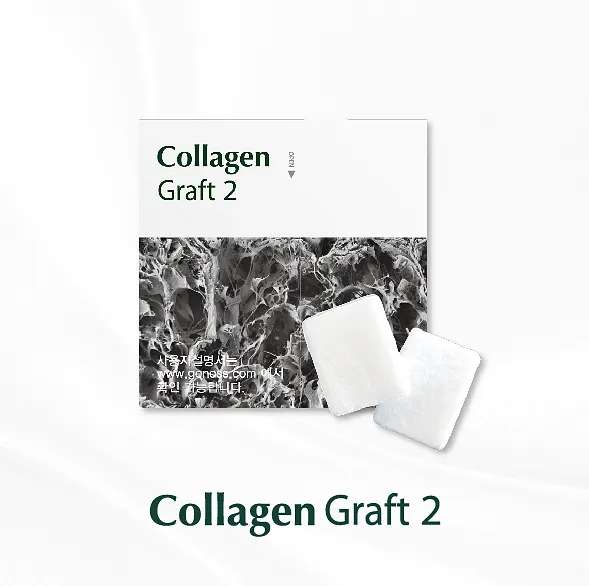 부착치은 재생과 차단막 기능을 동시에 수행하는 Collagen Graft 2 기질